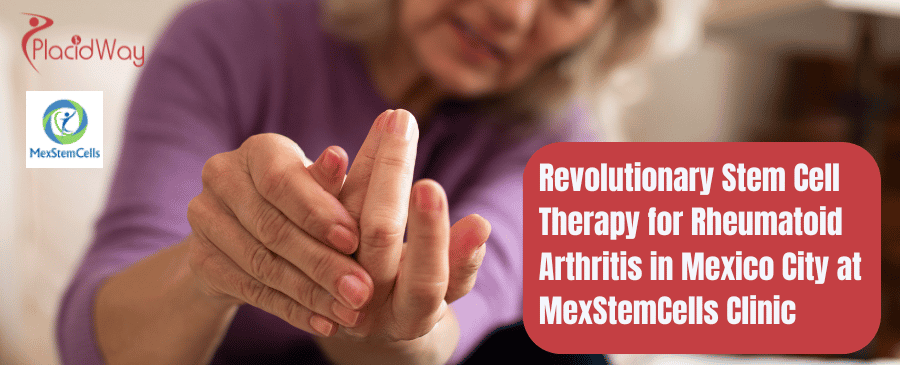 Revolutionary Stem Cell Therapy for Rheumatoid Arthritis in Mexico City at MexStemCells Clinic