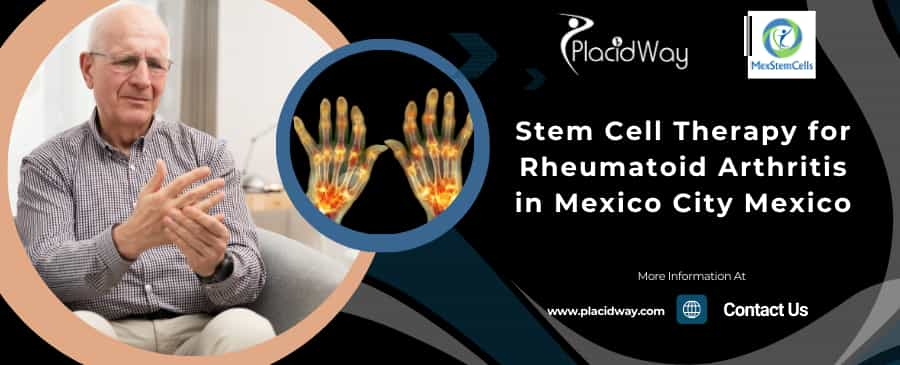 Stem Cell Therapy for Rheumatoid Arthritis in Mexico City Mexico