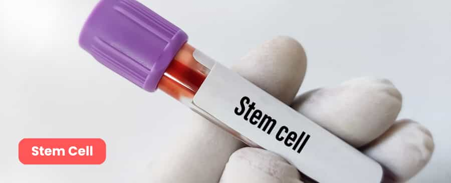 stem cell