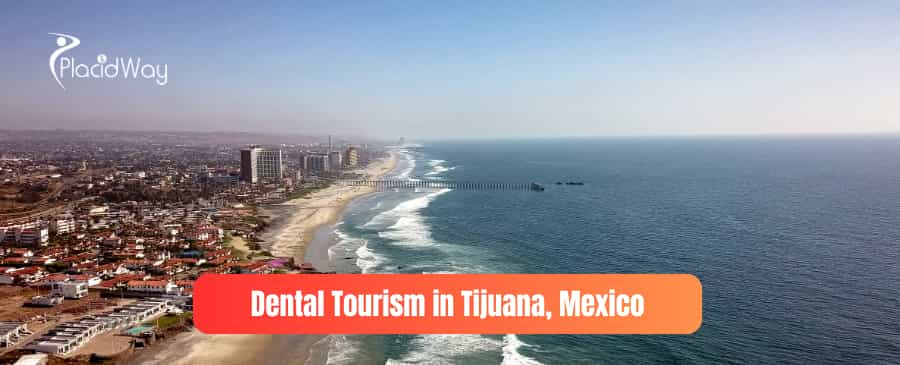 turismo dental en tijuana mexico