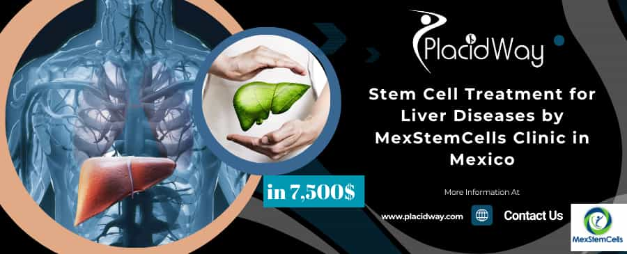 Stem Cell Treatment for Liver Diseases by MexStemCells Clinic in Mexico