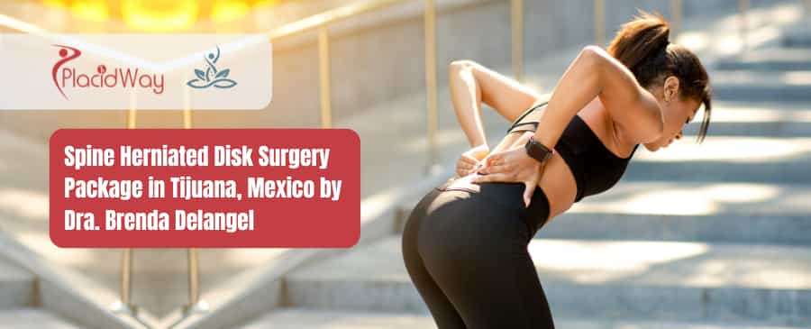 Spine Herniated Disk Surgery Package in Tijuana, Mexico by Dra. Brenda Delangel