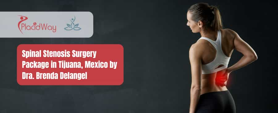 Spinal Stenosis Surgery Package in Tijuana, Mexico by Dra. Brenda Delangel