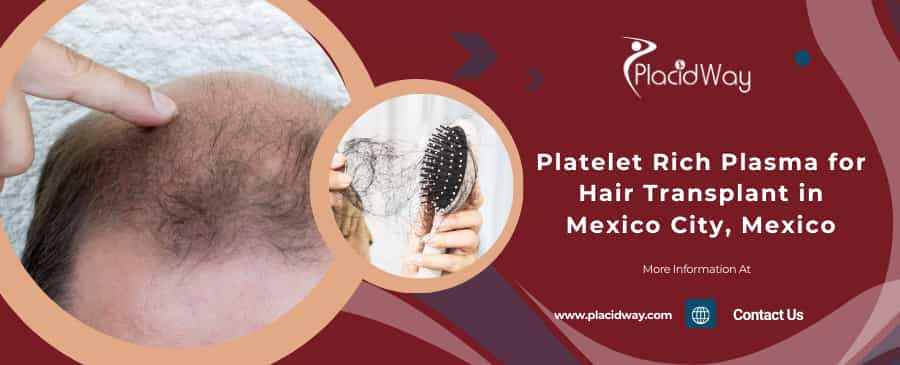 PRP for Hair Transplant in Mexico