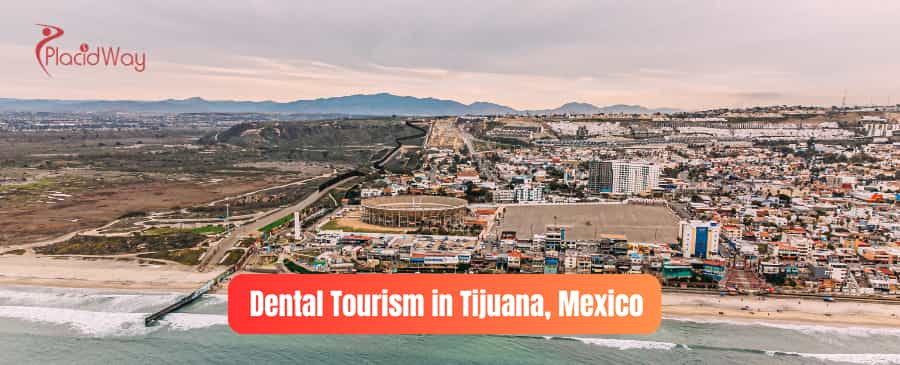 Turismo Dental en Tijuana México