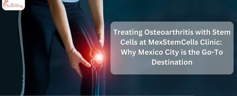 Treating Osteoarthritis with Stem Cells at MexStemCells Clinic:  Why Mexico City is the Go-To Destination