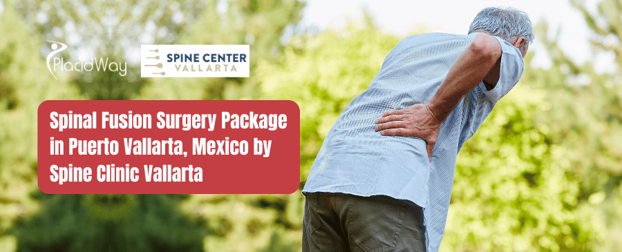 Spinal Fusion Surgery Package in Puerto Vallarta, Mexico by Spine Clinic Vallarta