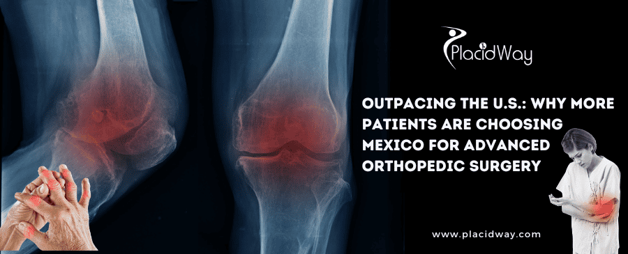 Outpacing the U.S.: Why More Patients Are Choosing Mexico for Advanced Orthopedic Surgery