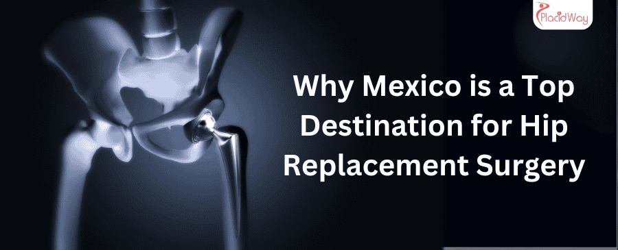 Why Mexico is a Top Destination for Hip Replacement Surgery