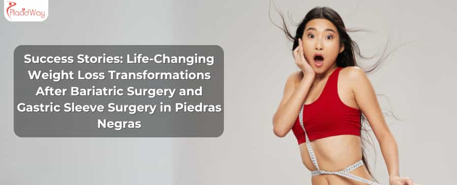 Success Stories: Life-Changing Weight Loss Transformations After Bariatric Surgery and Gastric Sleeve Surgery in Piedras Negras