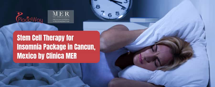 Stem Cell Therapy for Insomnia Package in Cancun, Mexico by Clinica MER