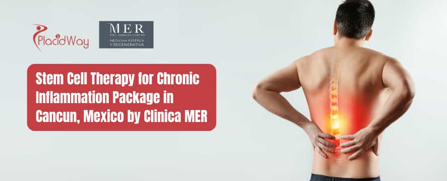 Stem Cell Therapy for Chronic Inflammation Package in Cancun, Mexico by Clinica MER