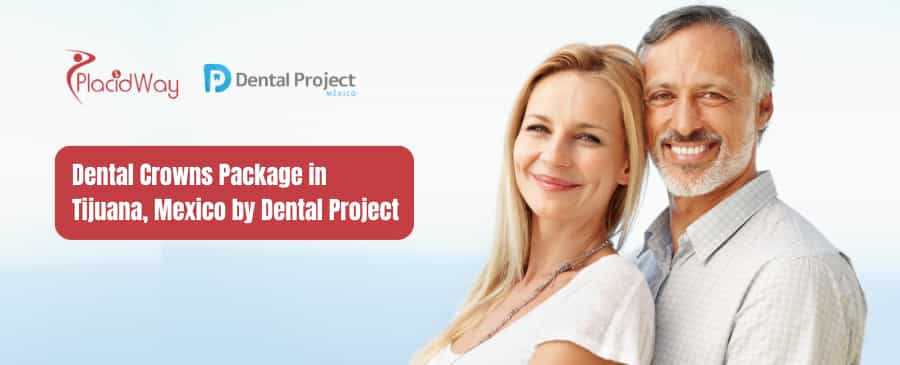 Dental Crowns Package in Tijuana, Mexico by Dental Project