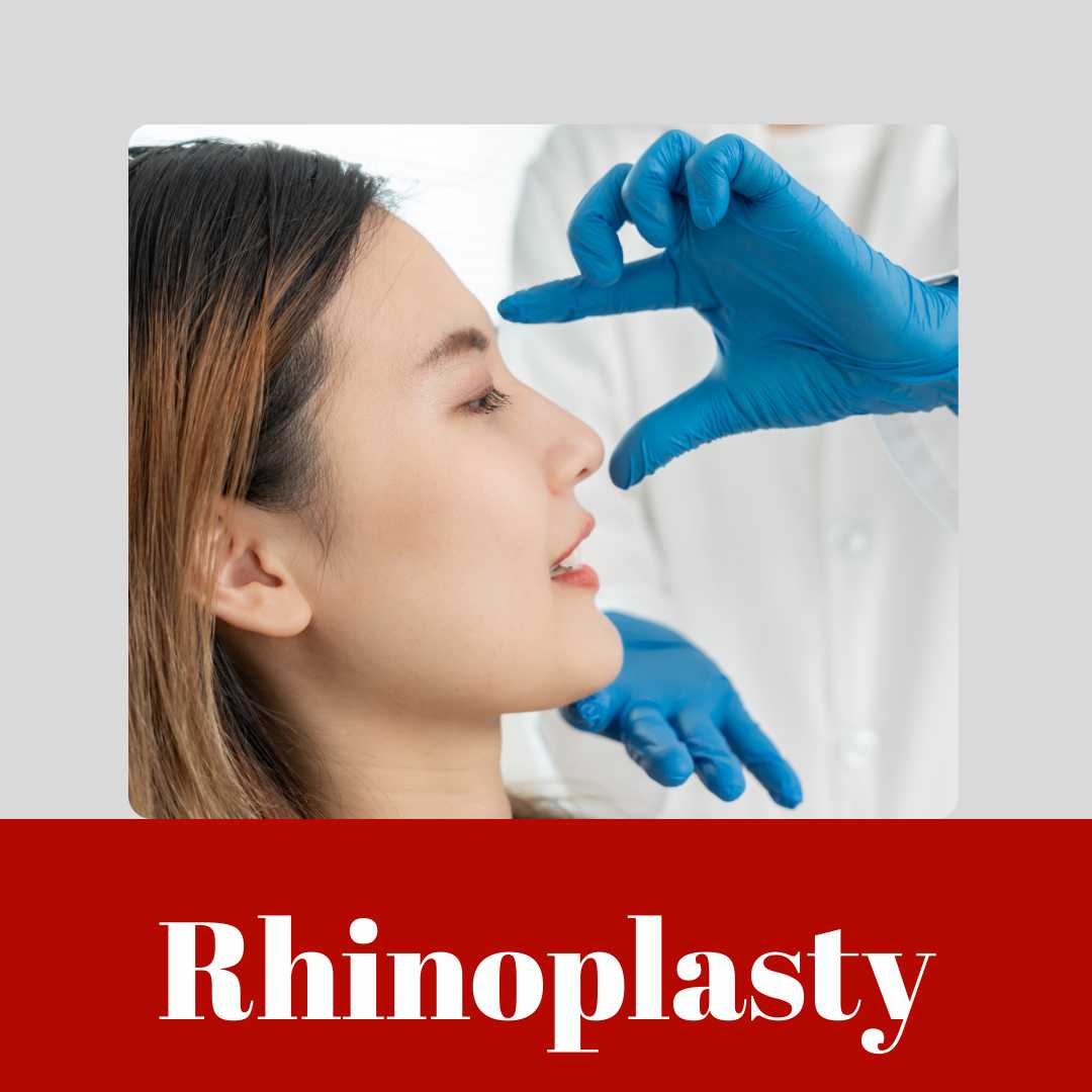 Rhinoplasty