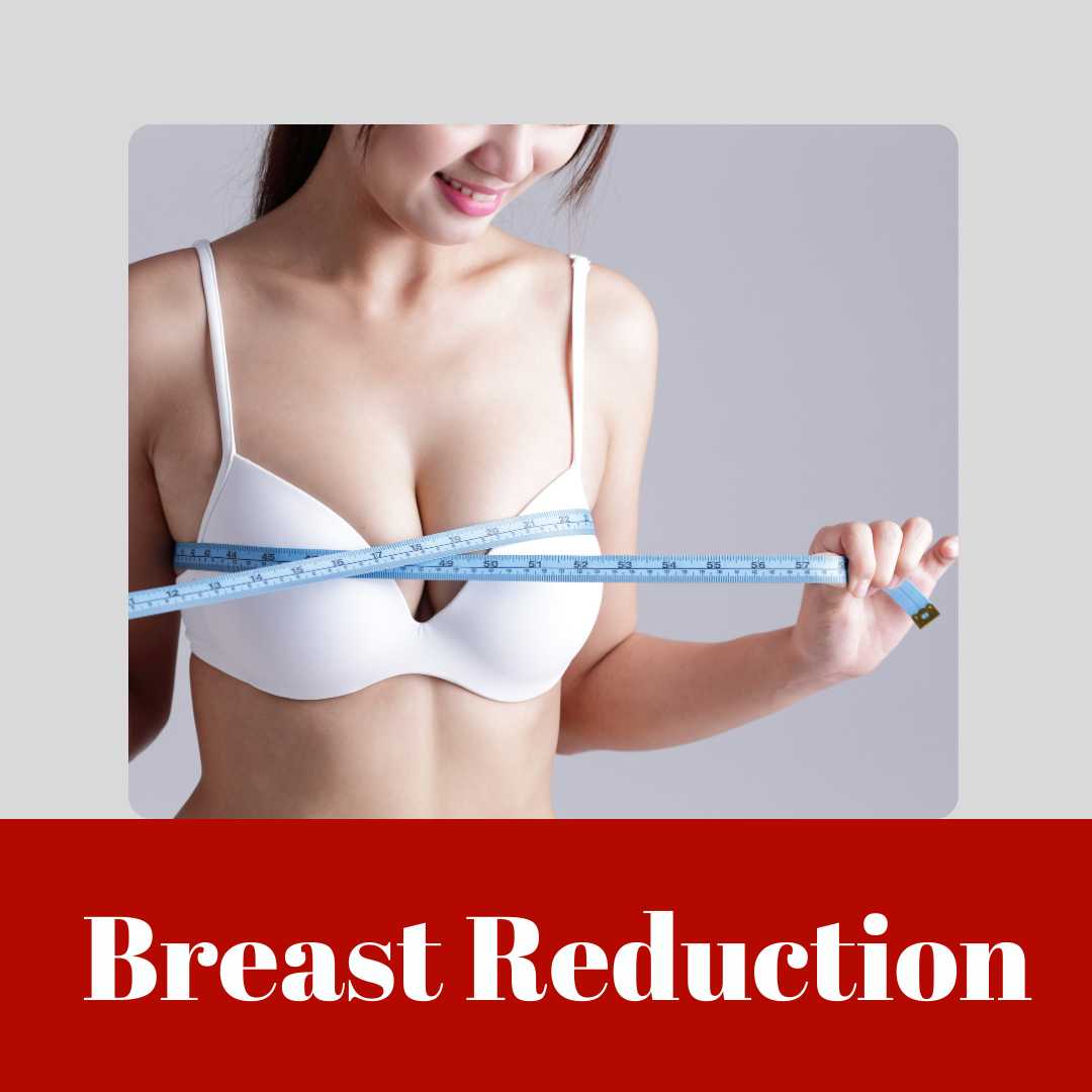 Breast Reduction