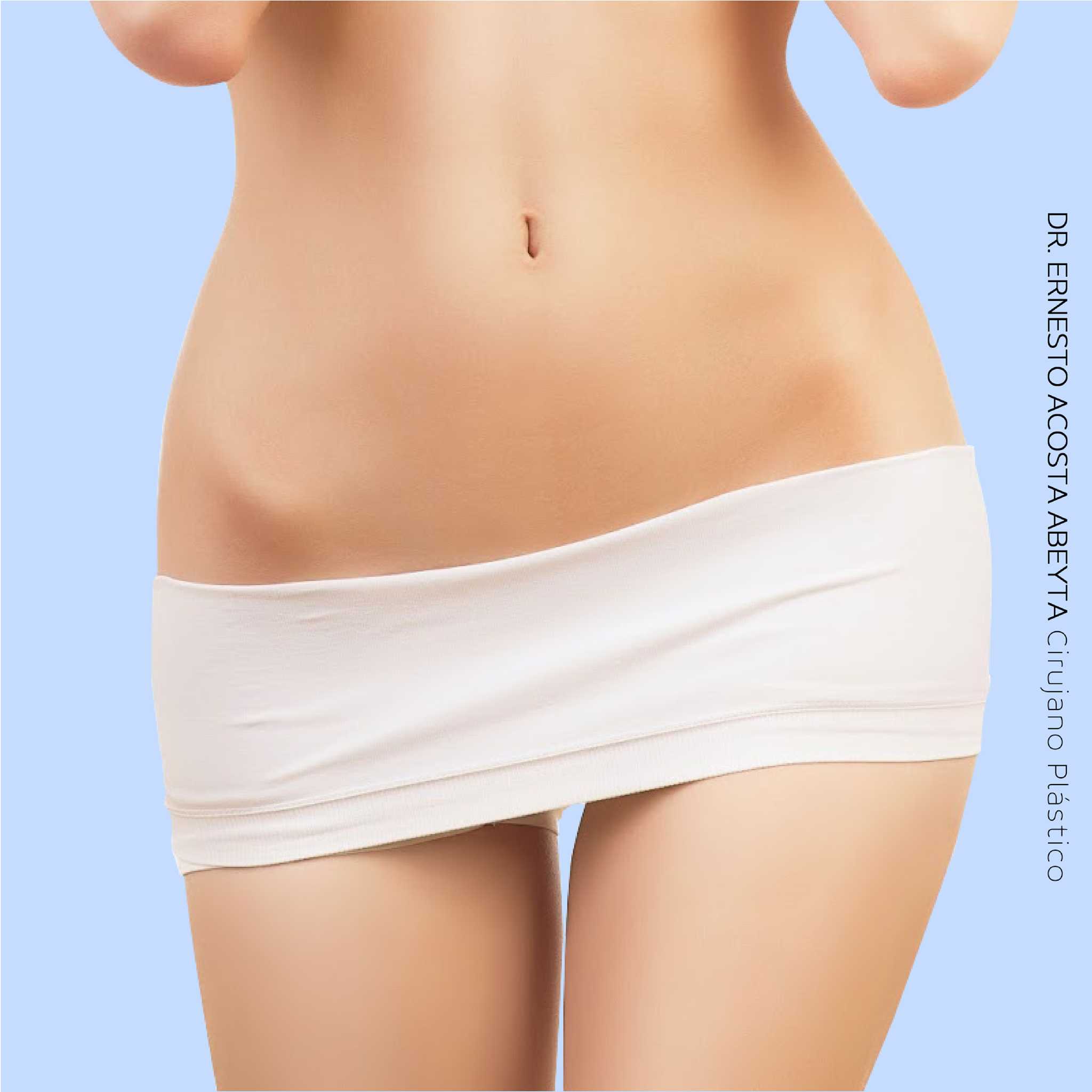 Liposuction in Merida Mexico