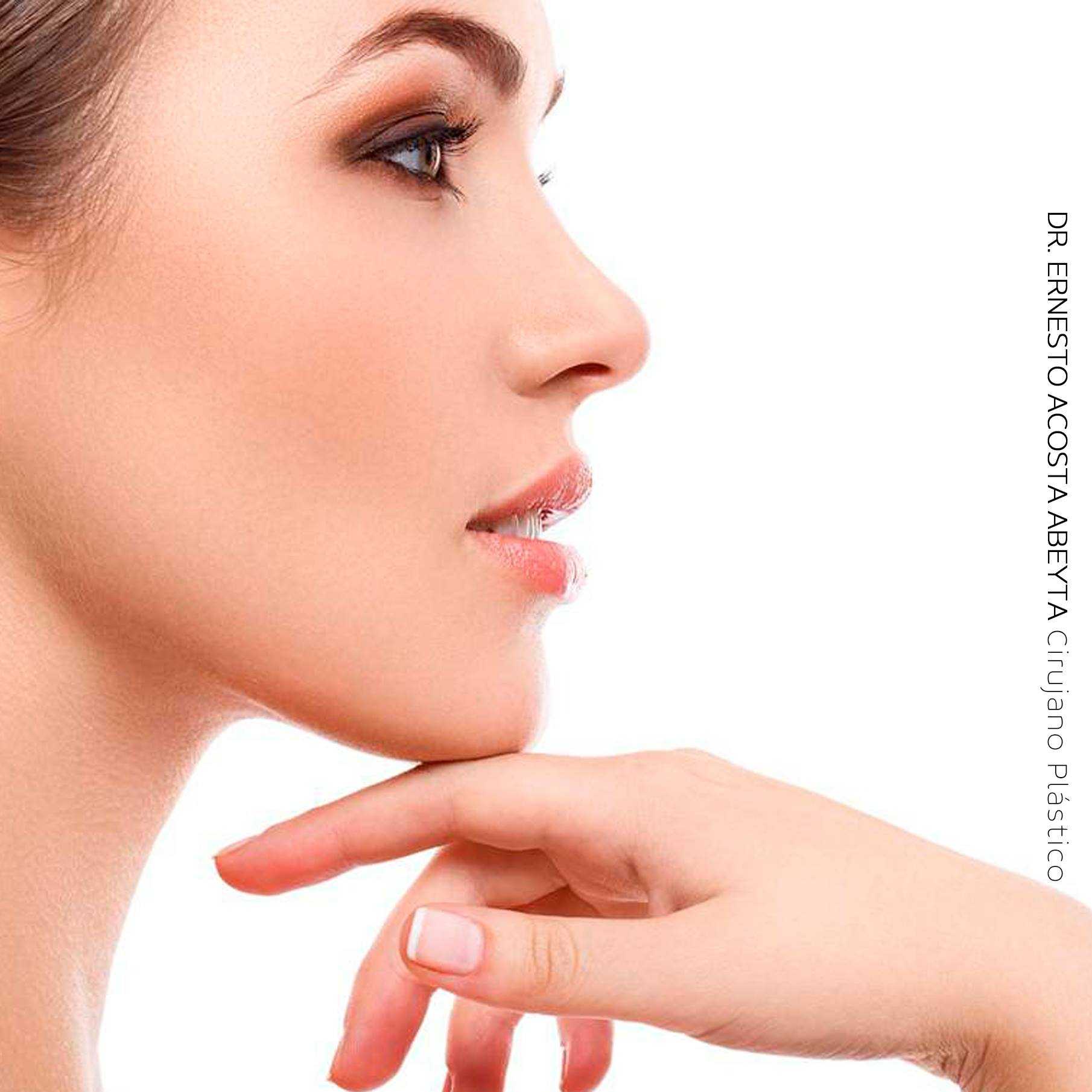 Rhinoplasty in in Merida Mexico