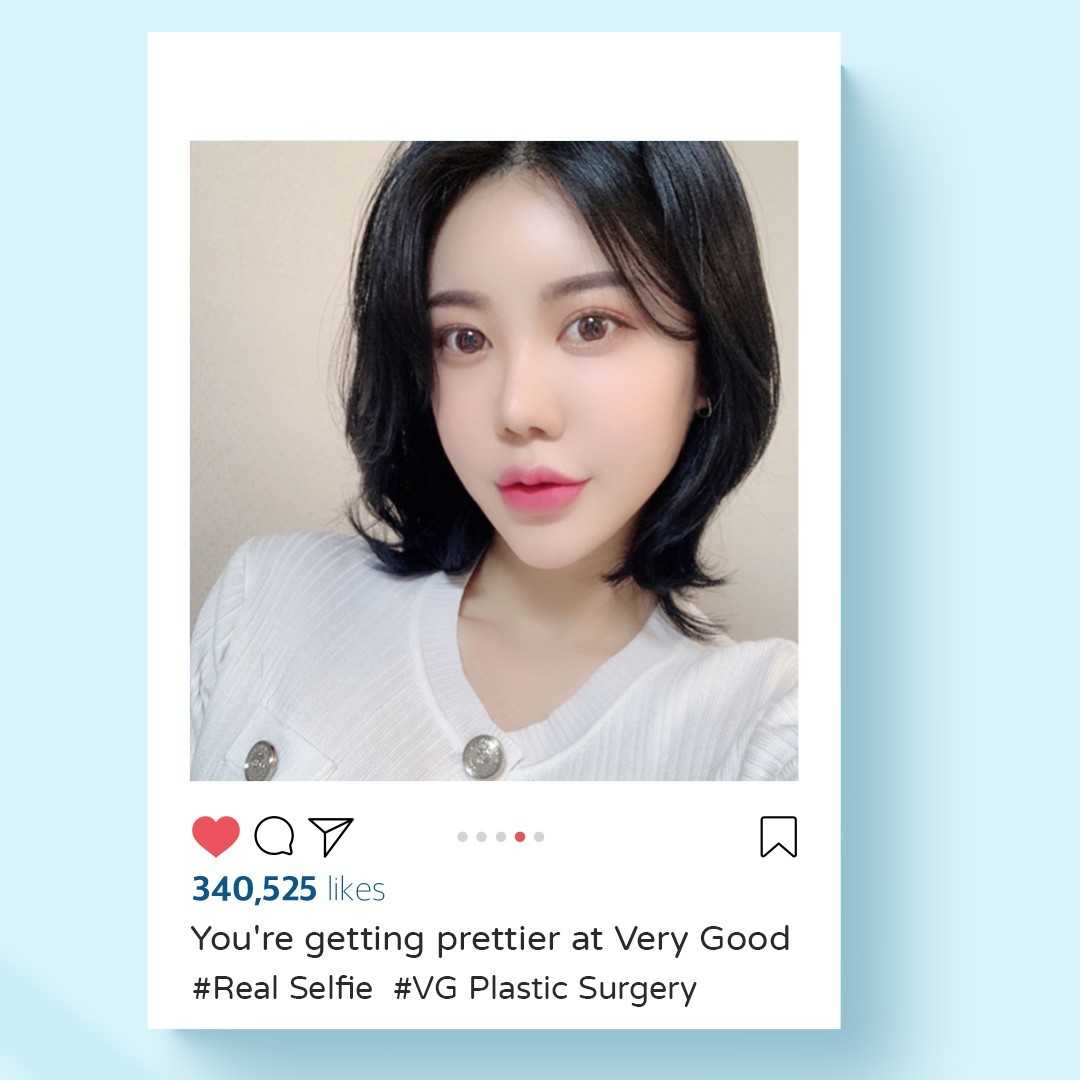 Plastic Surgery in Seoul South Korea Real Patient Story