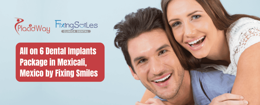 All on 6 Dental Implants Package in Mexicali, Mexico by Fixing Smiles