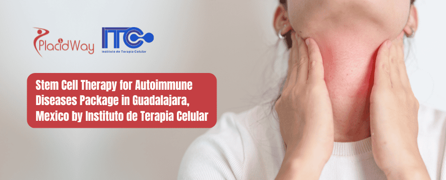 Stem Cell Therapy for Autoimmune Diseases Package in Guadalajara, Mexico by Instituto de Terapia Celular