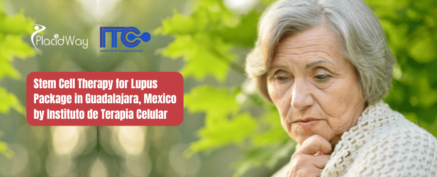 Stem Cell Therapy for Lupus Package in Guadalajara, Mexico by Instituto de Terapia Celular