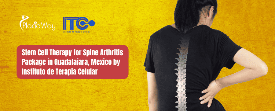 Stem Cell Therapy for Spine Arthritis Package in Guadalajara, Mexico by Instituto de Terapia Celular