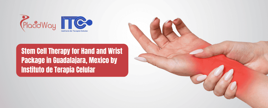 Stem Cell Therapy for Hand and Wrist Package in Guadalajara, Mexico by Instituto de Terapia Celular