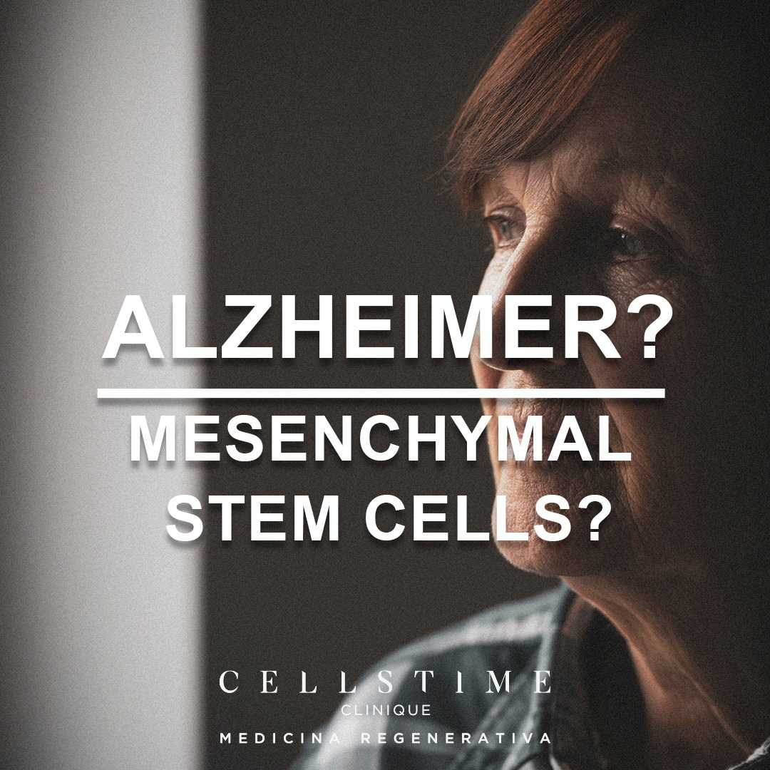 Stem Cell Therapy for Alzheimer's Disease Package in Tijuana, Mexico