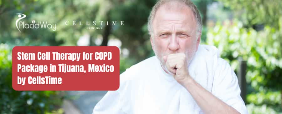 Stem Cell Therapy for COPD Package in Tijuana, Mexico by CellsTime