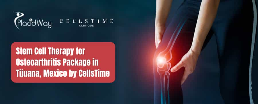 Stem Cell Therapy for Osteoarthritis Package in Tijuana, Mexico by CellsTime