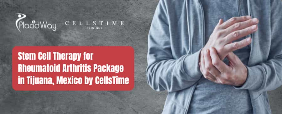 Stem Cell Therapy for Rheumatoid Arthritis Package in Tijuana, Mexico by CellsTime