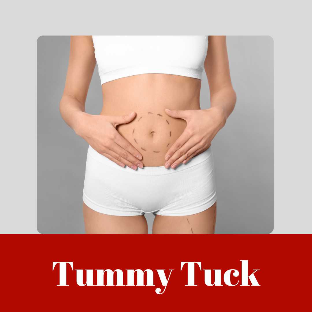 Tummy Tucks (Abdominoplasty)