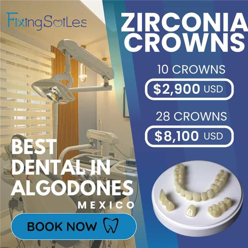 Dental Crowns Los Algodones Mexico