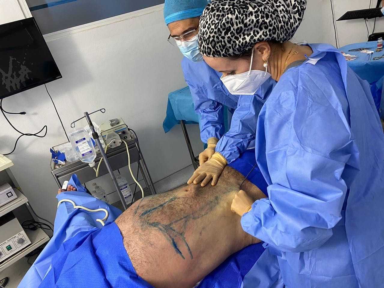 Tummy Tuck Dominican Republic