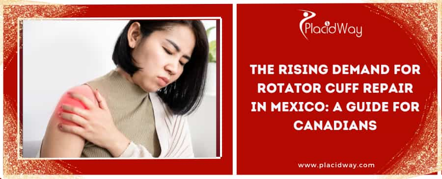 The Rising Demand for Rotator Cuff Repair in Mexico: A Guide for Canadians