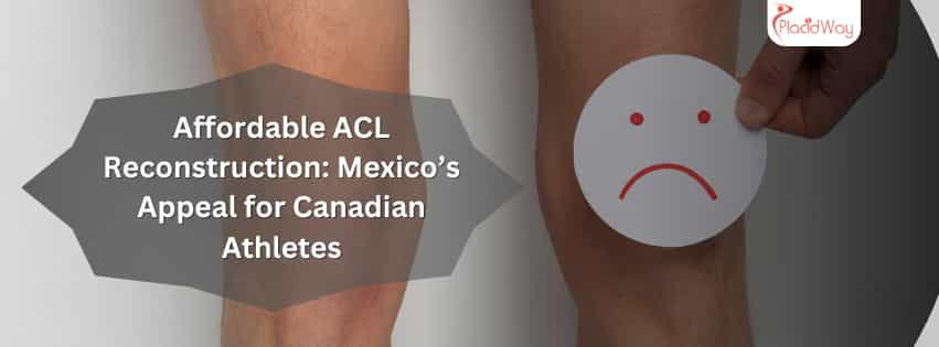 Affordable ACL Reconstruction: Mexico’s Appeal for Canadian Athletes