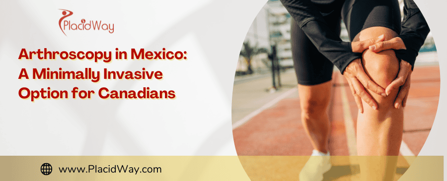 Arthroscopy in Mexico: A Minimally Invasive Option for Canadians