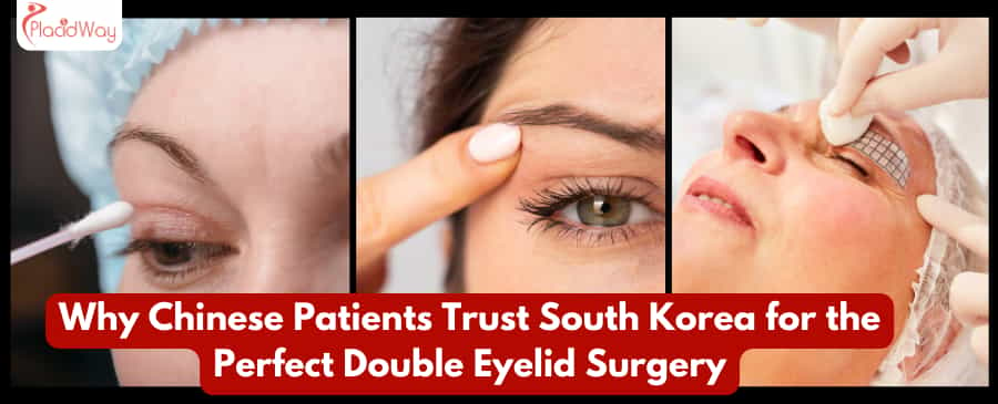 Why Chinese Patients Trust South Korea for the Perfect Double Eyelid Surgery