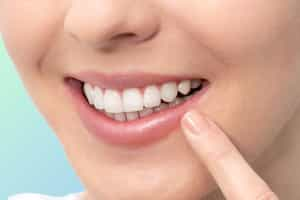 Dental Implants in Cancun