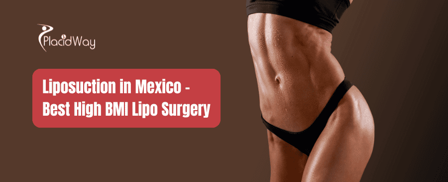 Liposuction in Mexico - Cost of Liposuction in Mexico