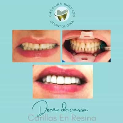 Carolina Hurtado - Comprehensive Dentistry