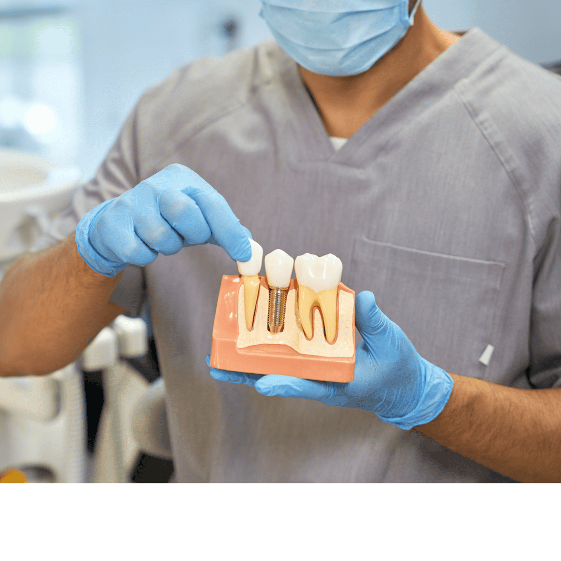 Dental Implants