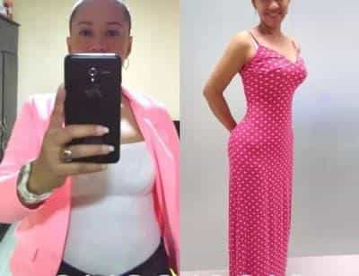 Before and After Breast Implant in Colombia