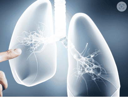 Alternative Lung Cancer Treatment Package