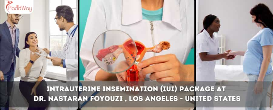 Intrauterine insemination (IUI) Package at  Dr. Nastaran Foyouzi , Los Angeles - United States