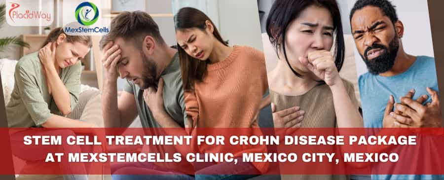 Stem Cell Treatment for Crohn Disease