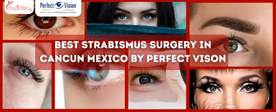 Best Strabismus Surgery in Cancun Mexico by Perfect Vison