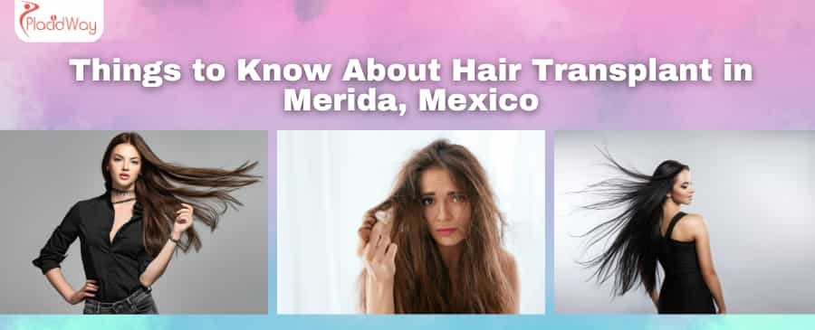 Things to Know About Hair Transplant in Merida, Mexico