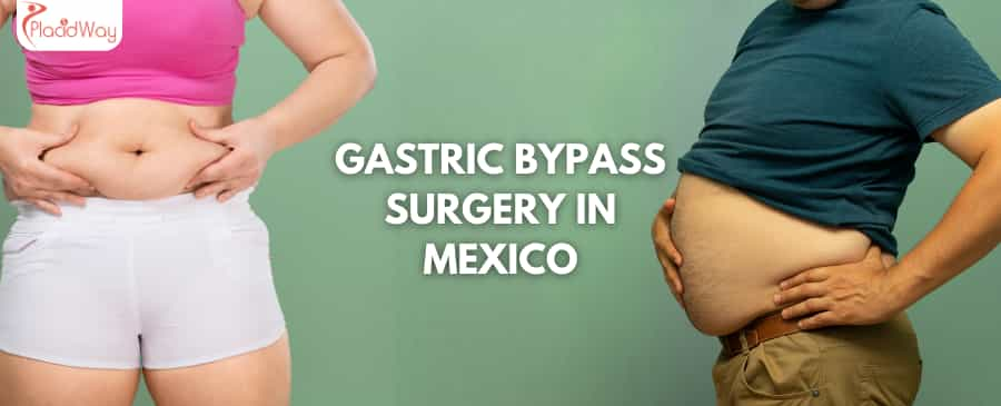 Gastric Bypass Surgery in Mexico