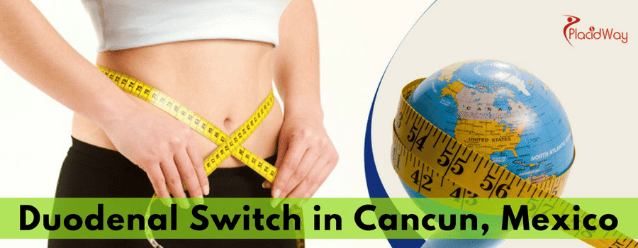 Duodenal Switch Surgery in Cancun, Mexico at an Affordable Price